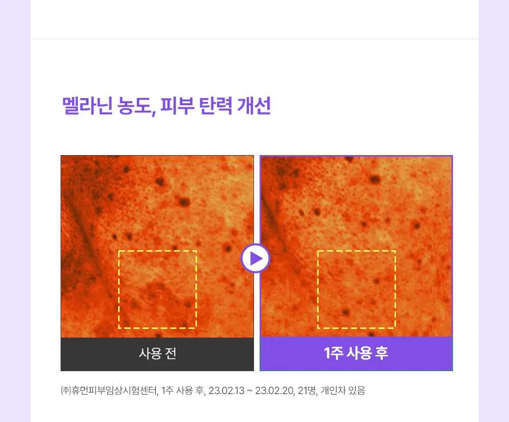 [잡티미백케어] 성분에디터 머루포도 비타 C 잡티크림 50g 상세페이지 33